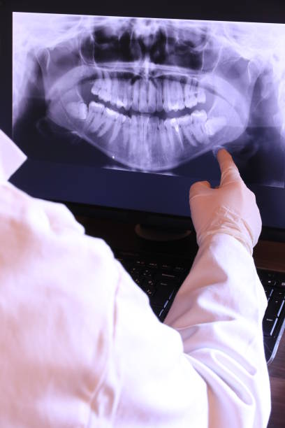 Best Emergency Dental Care for Broken or Chipped Teeth in Banner Elk, NC