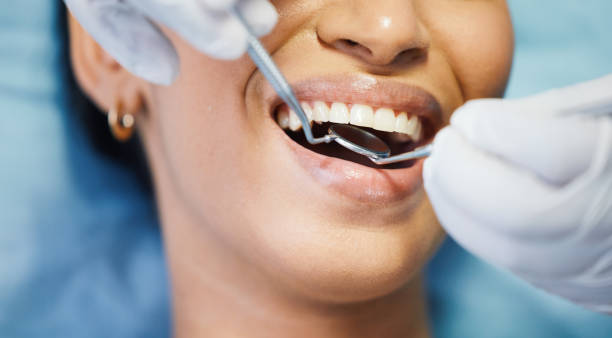 Best Emergency Treatment for Dental Infections or Abscesses in Banner Elk, NC